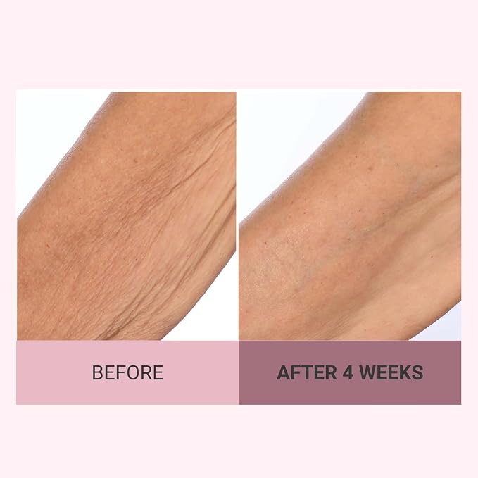 Consult Beaute Champagne Lift Hydrating Firming Body Cream - Image 6