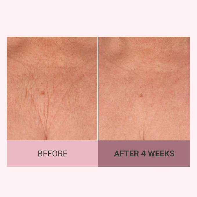 Consult Beaute Champagne Lift Hydrating Firming Body Cream - Image 4