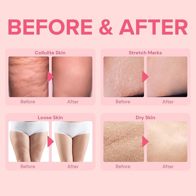 Anti Cellulite Body Firming Cream: Cellulite Remover - Image 4