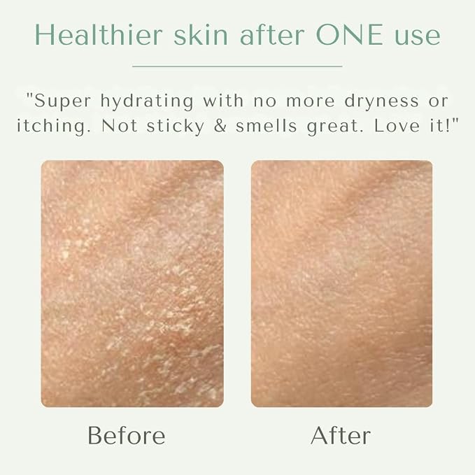 Yobee Body & Face Moisturizing Cream - Image 9