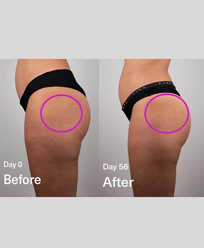 SickScience DropOff Advanced Exosome Body Firming & Sculpting Cream | Targets - Image 3
