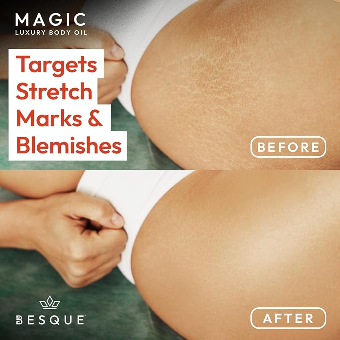 Besque Magic Body Oil, 3.38 FL OZ, After Shower Body Oil - Image 6