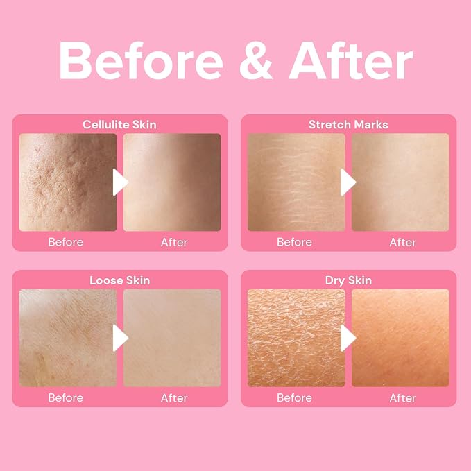Enaskin Naturals Anti-Cellulite Cream: Firming Solution - Image 2