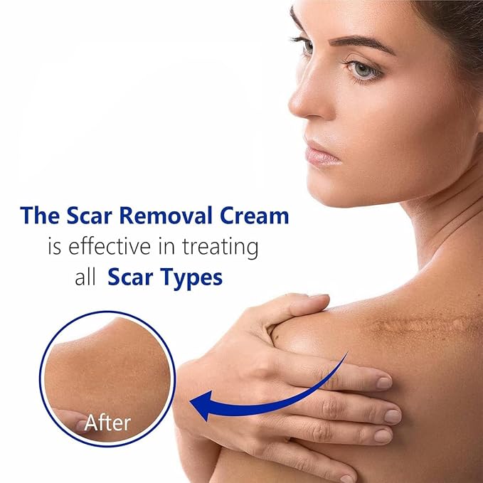 Advanced Scar Gel for Surgical Scars, Stretch Marks, Keloids - Image 3