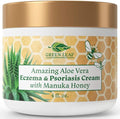 Manuka Honey Eczema Cream Moisturizing Lotion by AmazingAloeVerabyGLN