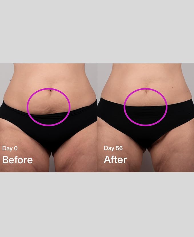 SickScience DropOff Advanced Exosome Body Firming & Sculpting Cream | Targets - Image 7