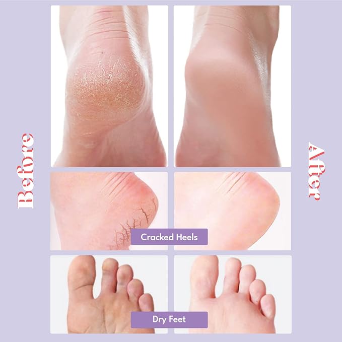 Toi:L Extra Silky Foot Mask 5 Pairs, Post-Peeling Foot Care Treatment, - Image 2