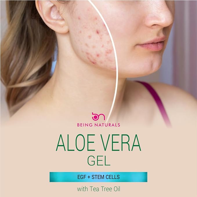 Being Naturals Aloe vera Gel - Image 2