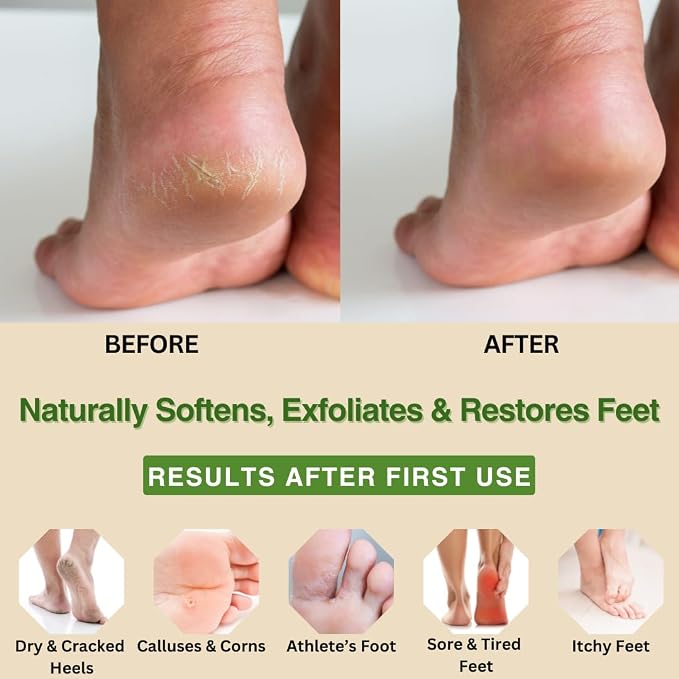 Natural Escapes Peppermint + Rosemary, Eucalyptus & Tea Tree Foot Cream - Image 3