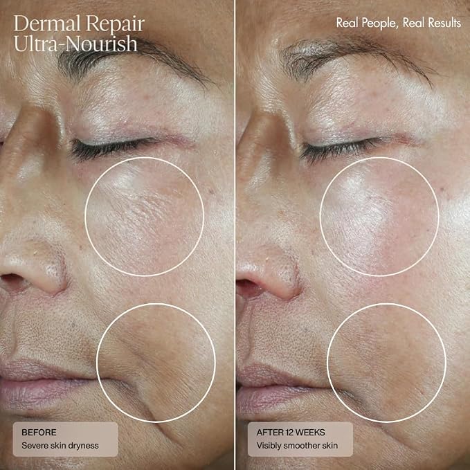 Senté Dermal Repair Ultra-Nourish | Rosacea Treatment - Image 6