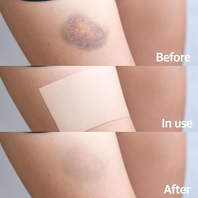 Arnica Hydrogel Pain Relief Patches | Natural Relief - Image 5