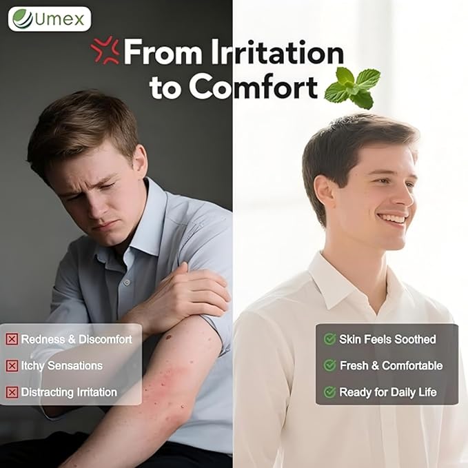 Umex Intensive Itch Relief Cream - Image 3