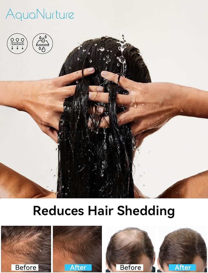 Filtered Shower Head with Filters, High Pressure Filter Showerhead - Image 2