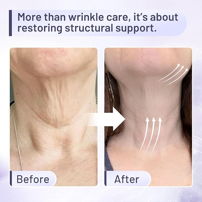 Premium Neck Creams For Tightening and Firming – Lifting Treatment for - Image 2