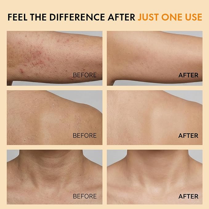 Keratin Care Kojic Acid Turmeric Exfoliating Body Spray - Image 4