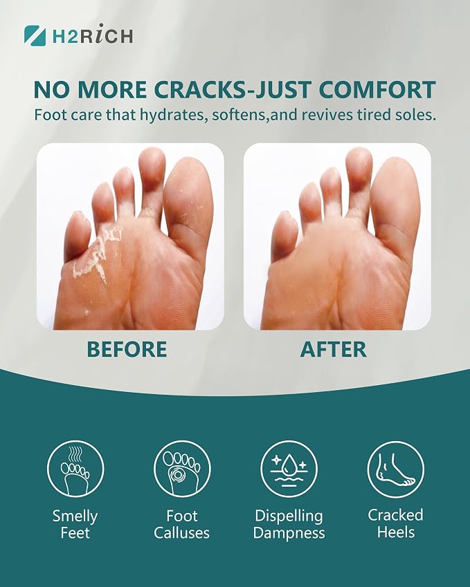 Hydrogen Foot Soak Effervescent Tablets 3 Pack | Ginger & Mugwort Herb Foot Bath - Image 4