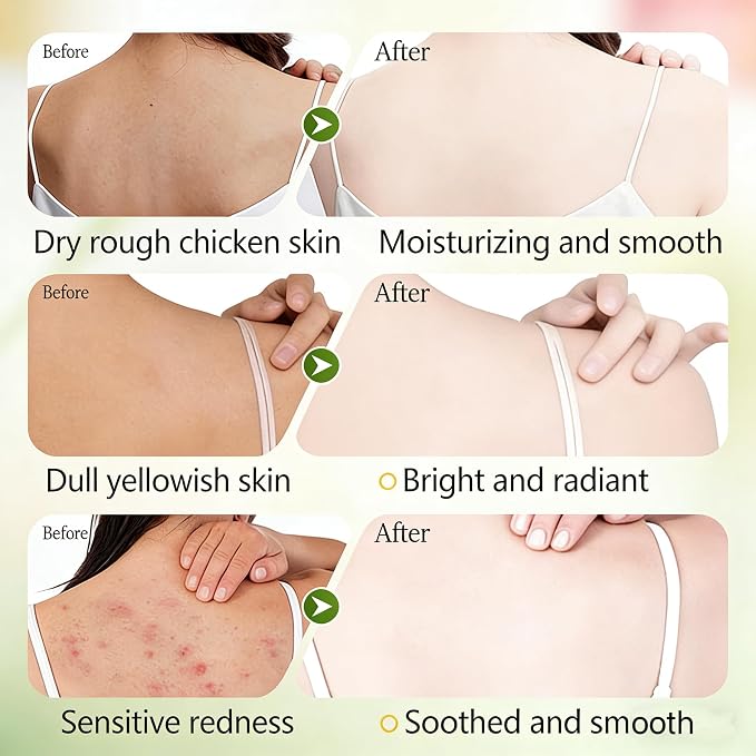 Shea Butter Body Lotion | Deep Moisturizing & Nourishing Cream | Long-Lasting - Image 5