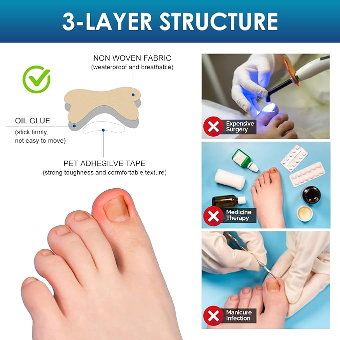 Ingrown Toenail Treatment, Professional-Grade Treatment - Image 3