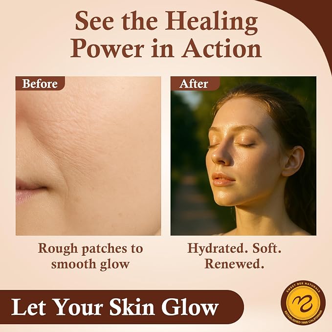 Sweet Bee Naturals - Image 7