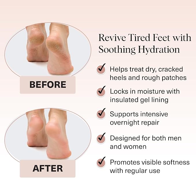 Kitsch Moisturizing Socks for Cracked Heel Treatment – Reusable Spa Socks for - Image 3