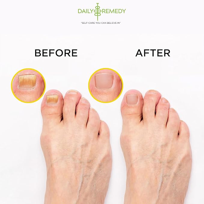 Citrus Detox Foot Soak with Epsom Salt - Image 6