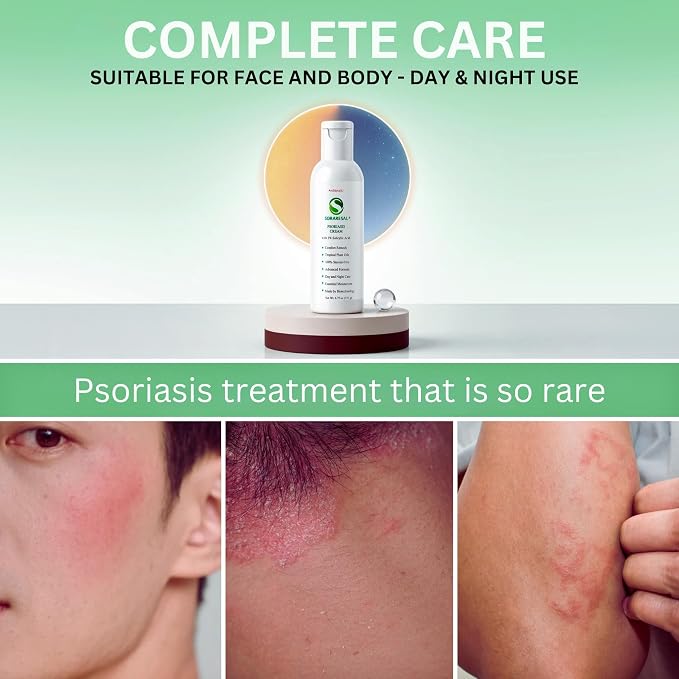 SORARESAL Psoriasis Cream – Comfort Remedy - Image 6
