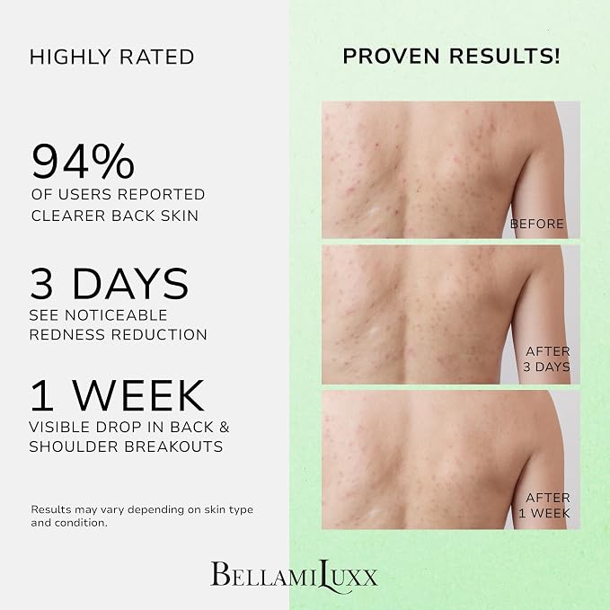 Back and Body Acne Treatment Spray: 2% Salicylic Acid & Tea Tree Oil Bacne Spray - Image 2