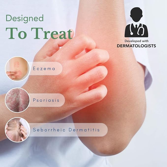 Theraplex AIM - Anti-Itch Moisturizing Cream - Non-stinging, Relieves Itching - Image 2