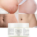 Stretch Marks Removal Cream for Pregnancy Massages Body & Reduces Scar by JellyMasks