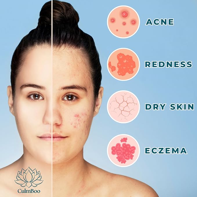 Hypochlorous Acid Spray for Face & Skin – HOCl Facial Toner & Hydrating Mist - Image 2