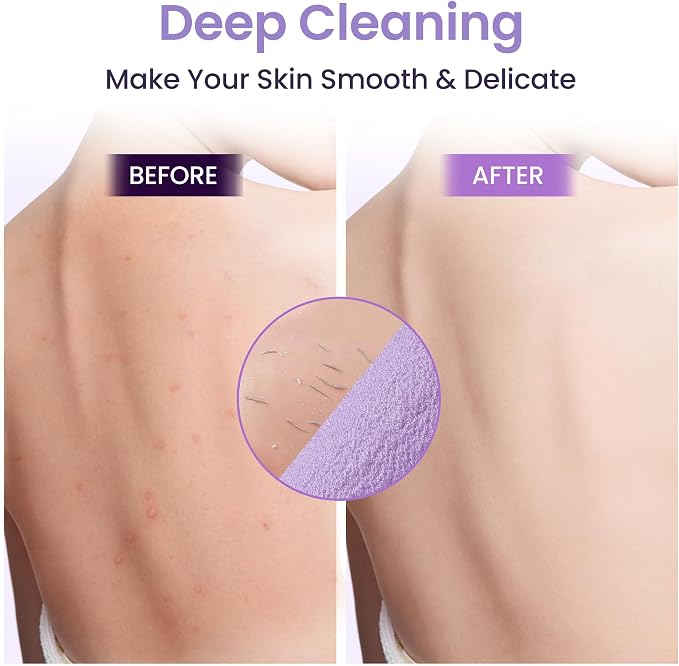 3 Pcs Double-Sided Back Exfoliator Body Scrub Towel, Exfoliating Back Scrubber - Image 5