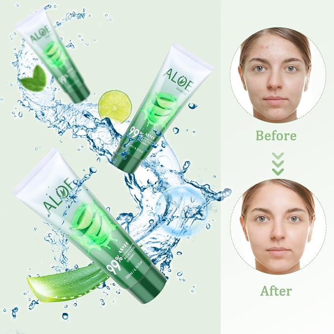 200x2 ML Aloe Vera Gel – 99% Organic Pure Aloe Vera Hydrating Face & Body - Image 4