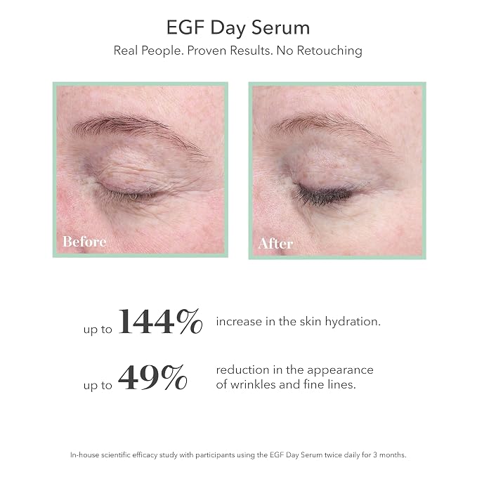 BIOEFFECT EGF Day Serum with Hyaluronic Acid and Natural Barley Growth Factor - Image 2
