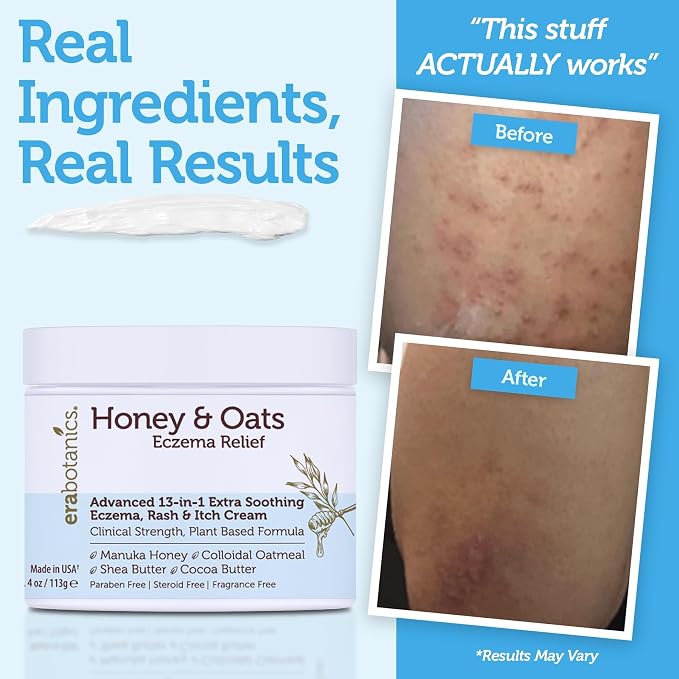 Eczema Cream with Manuka Honey & Colloidal Oatmeal – Extra Strength Anti Itch - Image 5