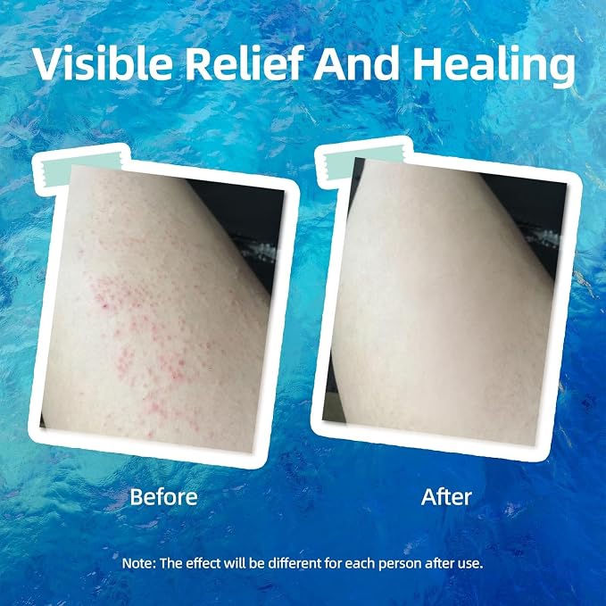 Crogooe Natural Soothing Eczema Cream - Image 7