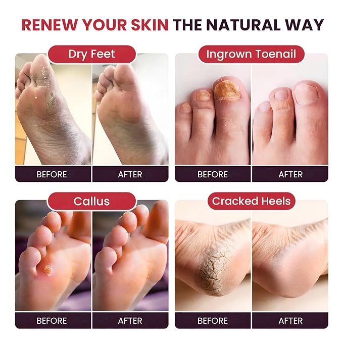 FOOT CURE Foot Soak with Epsom Salts – All-Natural Blend - Image 3
