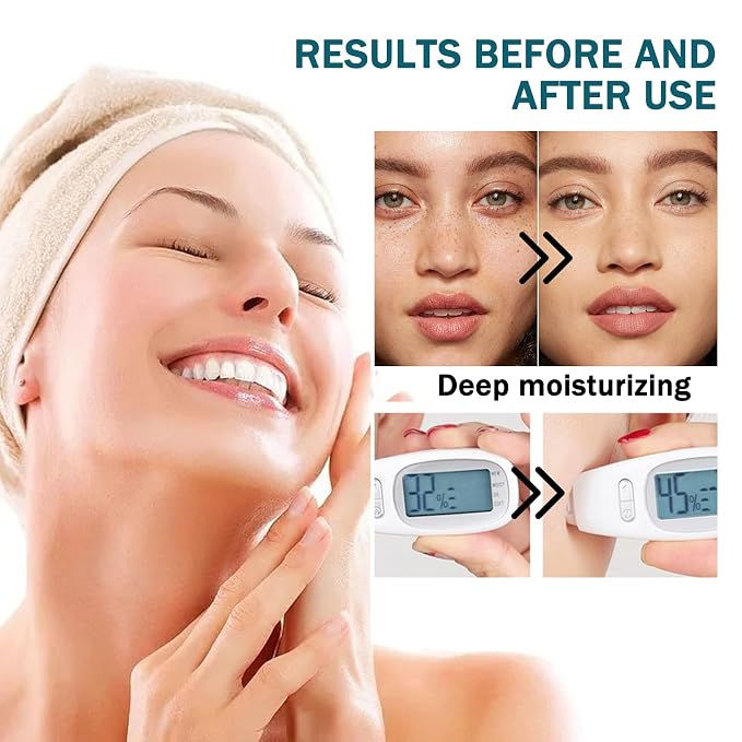 16PCS Aloe Vera Gel for Face and Body, Hydrating Aloe Vera Gel, Cooling - Image 4