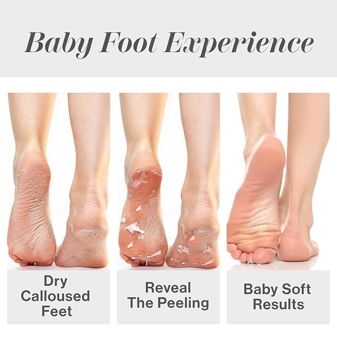 Baby Foot Original Exfoliation Foot Peel - Image 4