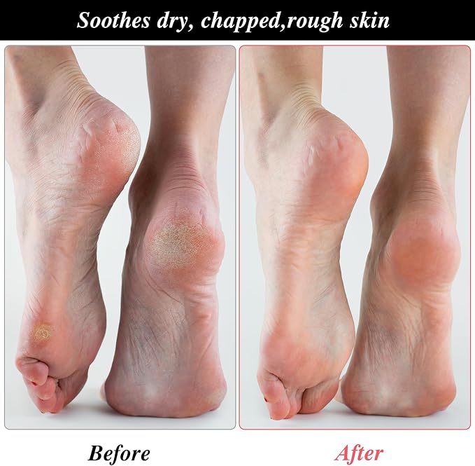 3 Pairs Foot Moisturiser Socks Overnight, Spa Cotton Socks - Image 4