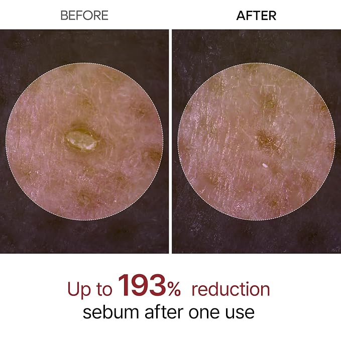 Dr.Melaxin Peel Shot Glow White and Black Rice Ampoule Duo, Soft Exfoliating - Image 3