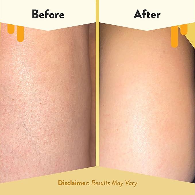 ECZEMA HONEY Soothing Body Wash - Image 4