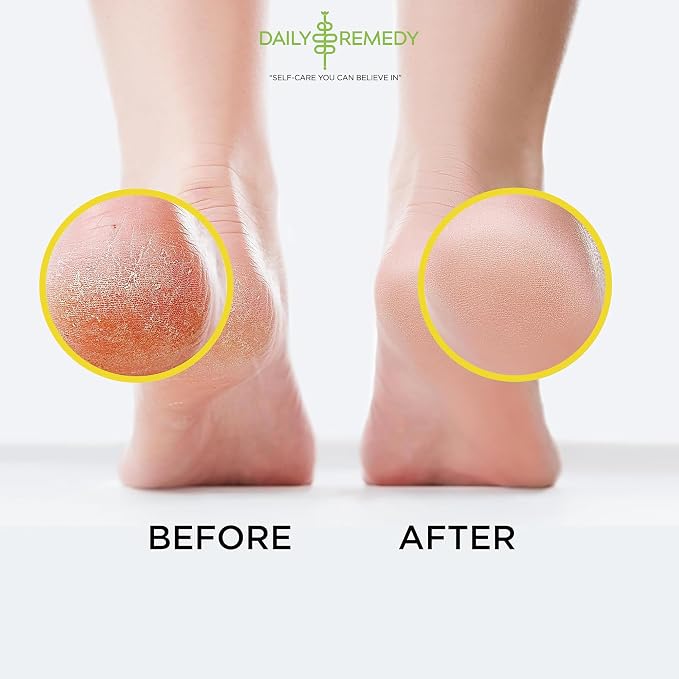 Citrus Detox Foot Soak with Epsom Salt - Image 5
