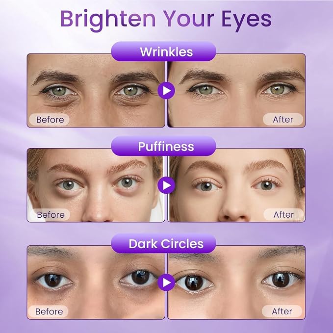 Retinol Under Eye Cream for Dark Circles & Puffiness – Anti-Aging Eye Cream for - Image 6