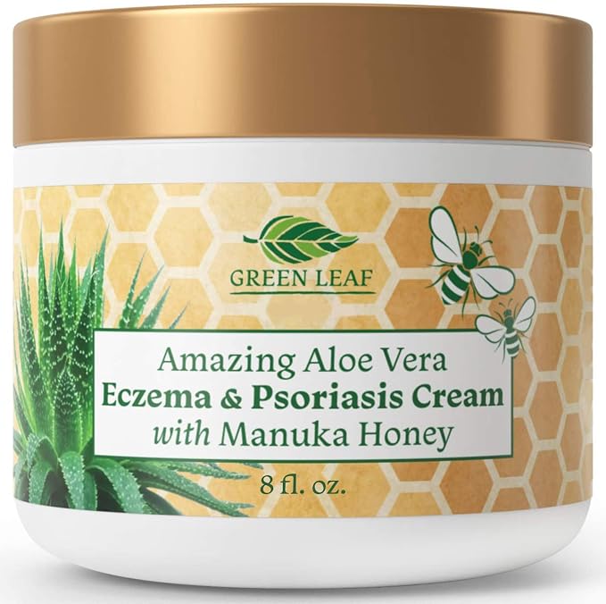 Manuka Honey Eczema Cream Moisturizing Lotion Treatment by AmazingAloeVerabyGLN