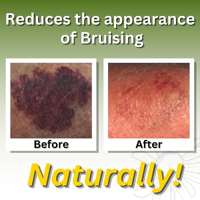 Relief Arnica Cream Natural Lotion - Image 3