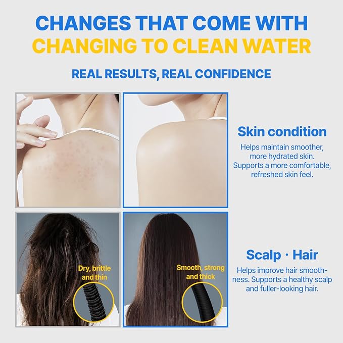 Filter Shower For K-Beauty Skin Care– Pure Carbon Filters for Softer Skin & - Image 9