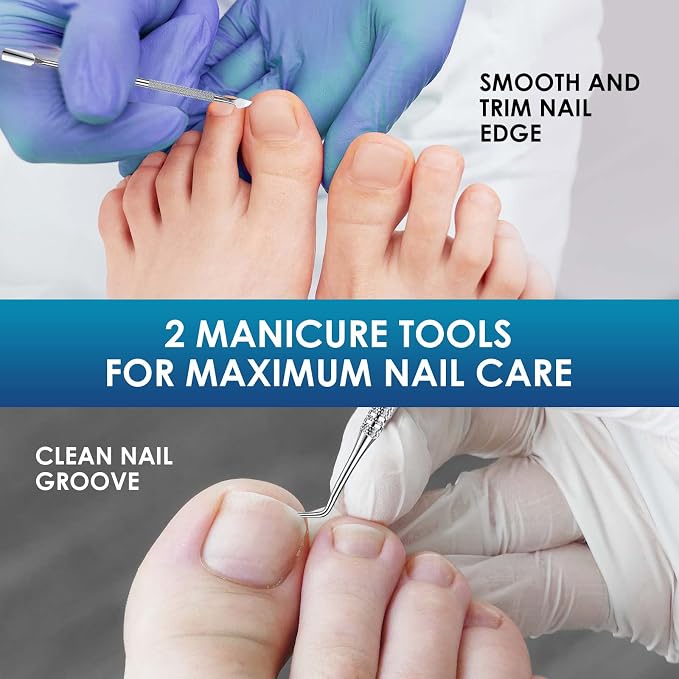 Ingrown Toenail Treatment, Professional-Grade Treatment - Image 5