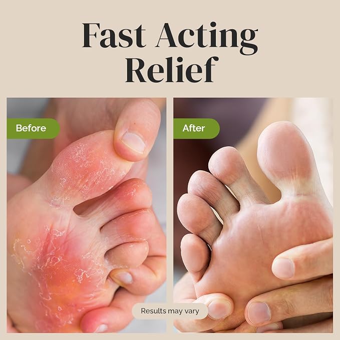 Puriya Clinically Proven Antifungal Cream - Image 3