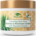 Manuka Honey Eczema Cream Moisturizing Lotion Treatment by AmazingAloeVerabyGLN