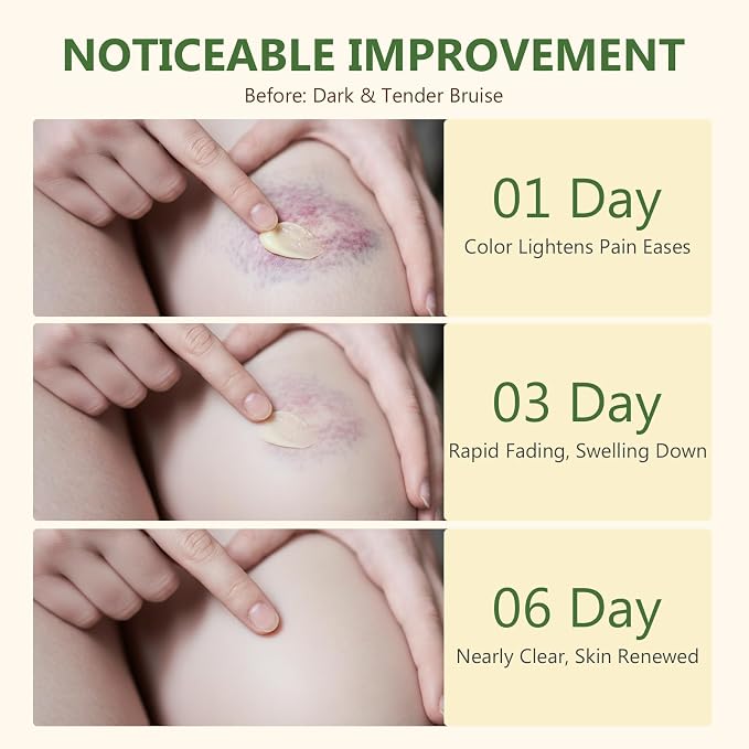 Helichrysum Balm, Natural Soothes & Repairs Bruised & Fragile Skin, Improve - Image 7